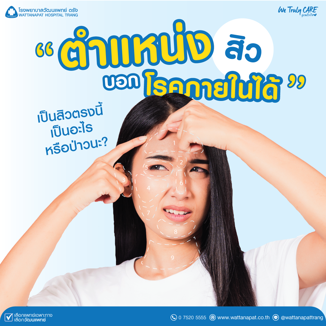 ตำแหน่งสิวบอกโรค