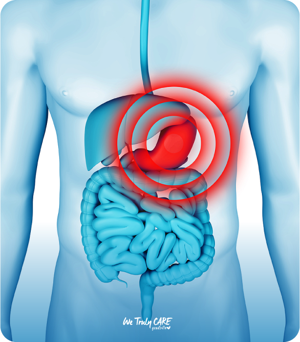 การส่องกล้องกระเพาะอาหาร