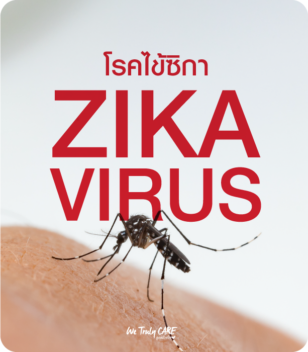 โรคไข้ซิกา