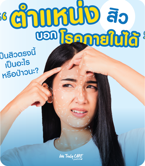 ตำแหน่งสิวบอกโรค