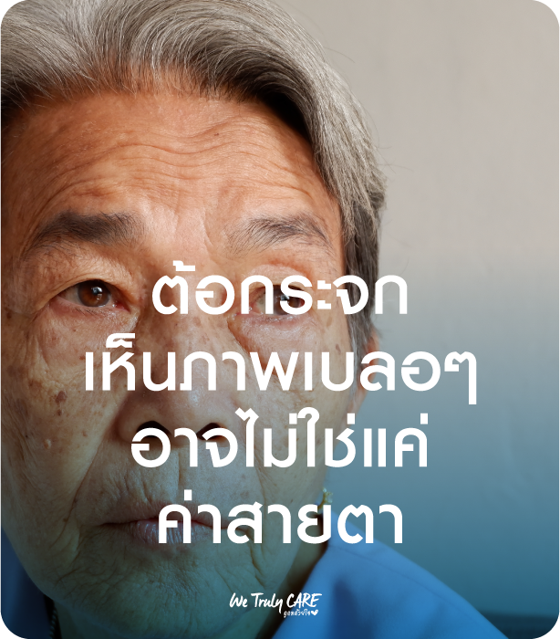 ต้อกระจก เห็นภาพเบลอๆอาจไม่ใช่แค่ค่าสายตา