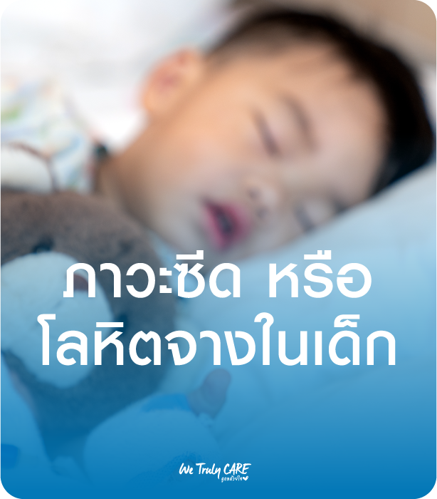 ภาวะซีด หรือโลหิตจางในเด็ก