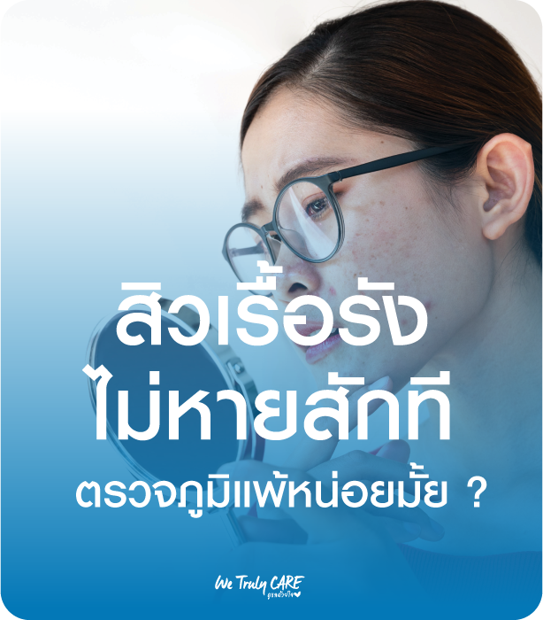 สิวเรื้อรังไม่หายสักที ลองตรวจภูมิแพ้ดูสักทีดีมั้ย