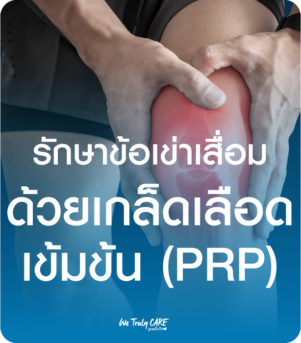 รักษาข้อเข่าเสื่อม ไม่ต้องผ่าตัดด้วยการฉีดเกล็ดเลือดเข้มข้น PRP