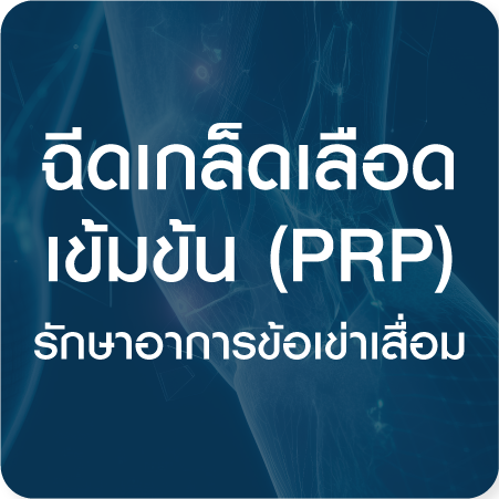 ฉีดเกล็ดเลือดเข้มข้น (PRP) รักษาอาการข้อเข่าเสื่อม