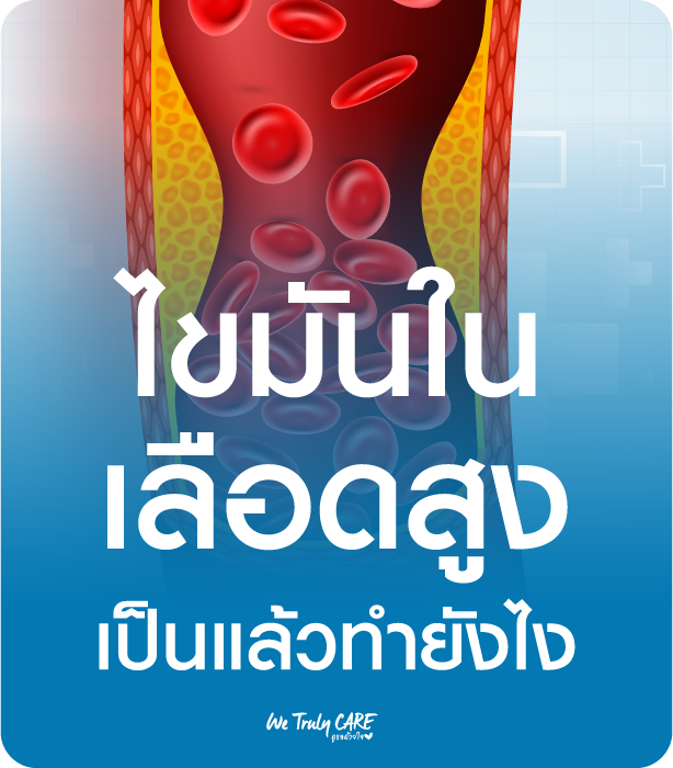ไขมันมันในเลือดสูงทำคุณเสี่ยงโรคหัวใจและหลอดเลือด