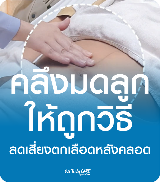 คลึงมดลูกให้ถูกวิธี ลดความเสี่ยงตกเลือดหลังคลอด พร้อมวิดีโอสอน