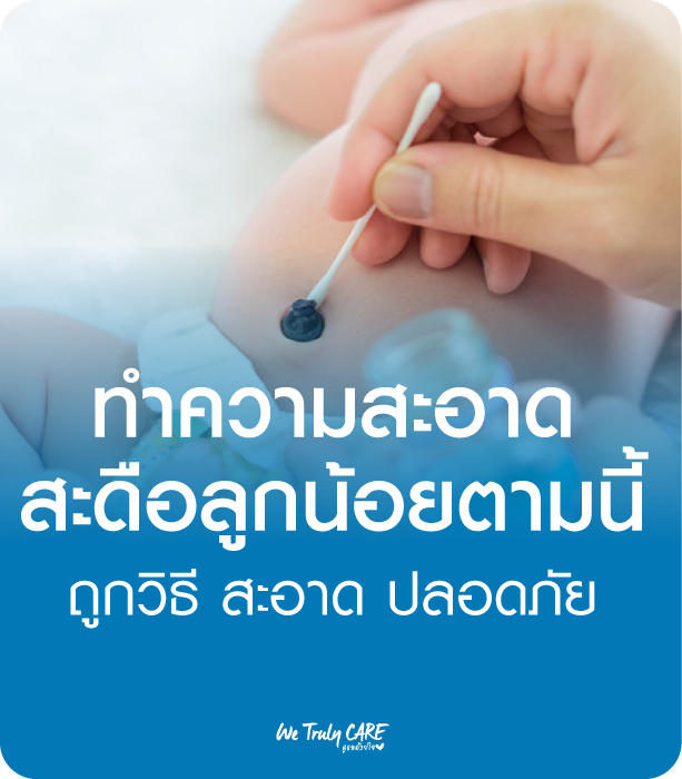 ทำความสะอาด สะดือลูกน้อยตามนี้ ถูกวิธี สะอาด ปลอดภัย
