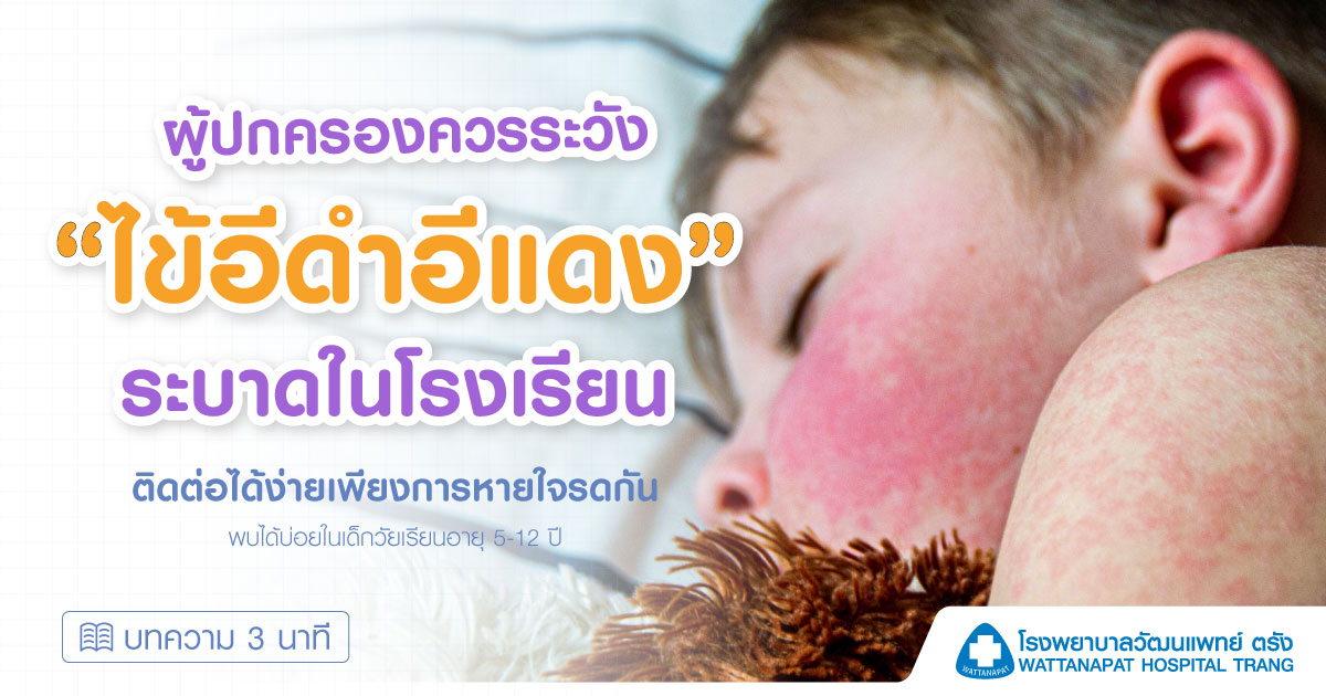 ผู้ปกครองควรระวัง ไข้อีดำอีแดง ระบาดในเด็กวัยเรียน